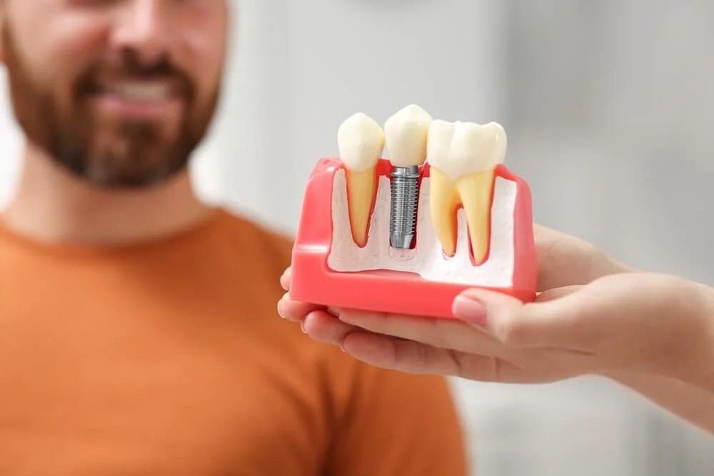 Dental Implant Systems