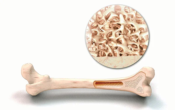 Costal Cartilage Allografts